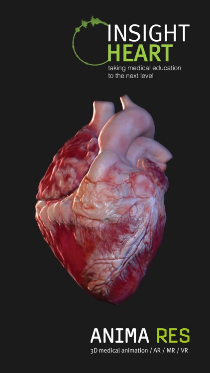 INSIGHT HEART screenshot-4