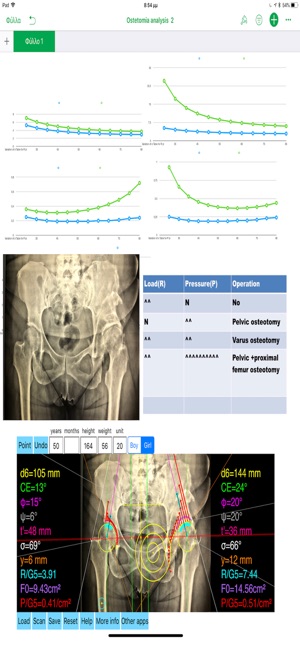 HipBiomechanicsApp(圖9)-速報App