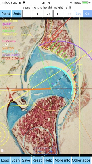 PapadimitriouAbductionSplint(圖4)-速報App