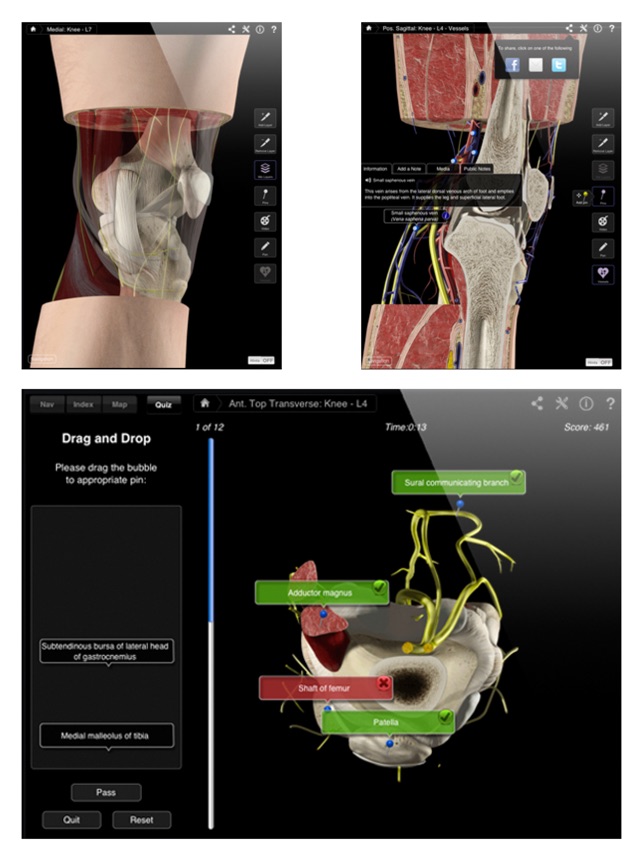 Knee Pro III for iPad(圖5)-速報App