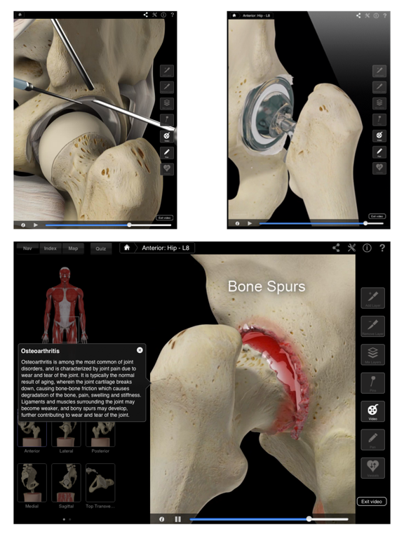 Hip Pro III for iPadのおすすめ画像2