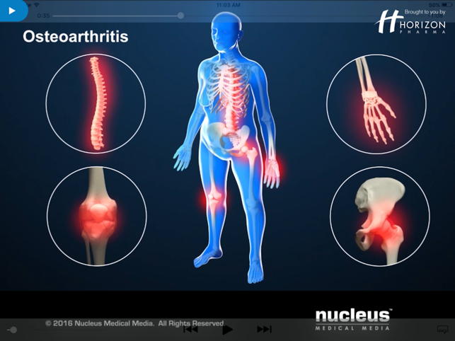 Arthritis Touch(圖2)-速報App