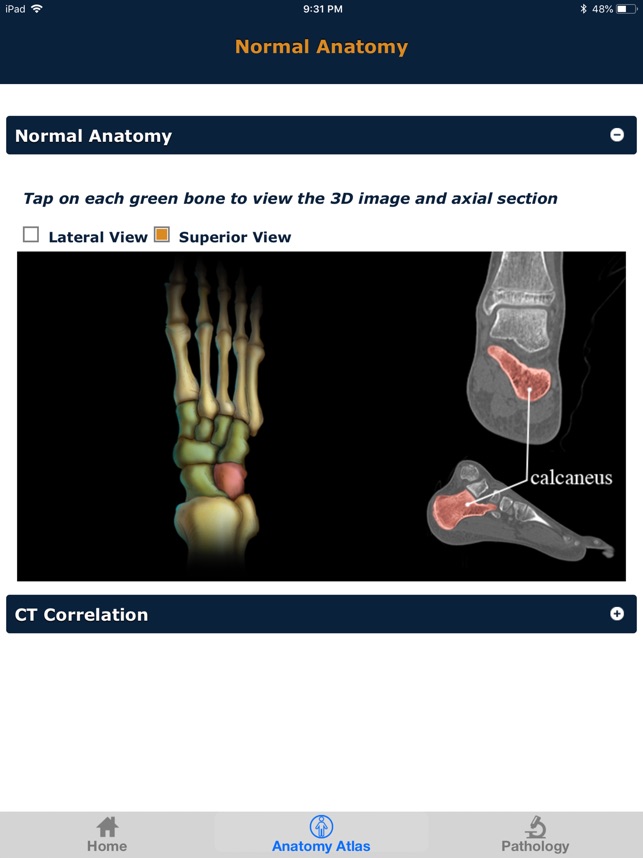 CTisus: CT of the Foot(圖3)-速報App