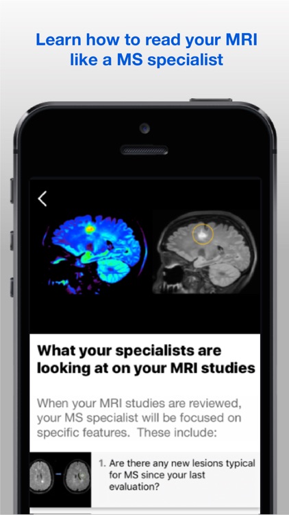 Understanding MRI: MS screenshot-3