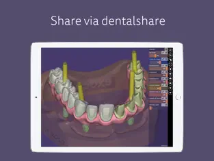 Captura 2 exocad webview - STL Viewer iphone