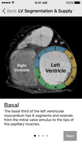 Game screenshot Cardiac Imaging Planes 1-2-3 apk