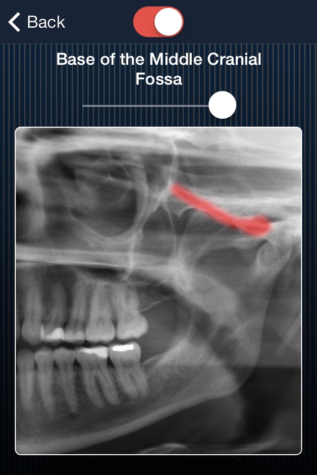 Dental Panoramic Radiology screenshot 3