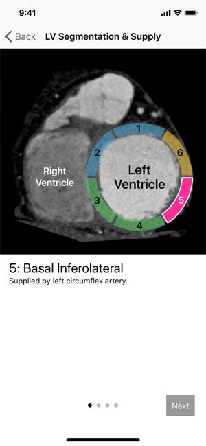 Cardiac Imaging Planes 1-2-3(圖2)-速報App