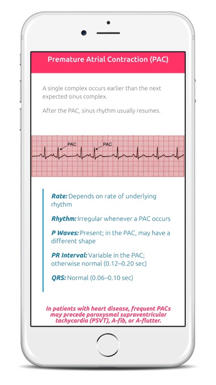 ECG FlashCards Pro