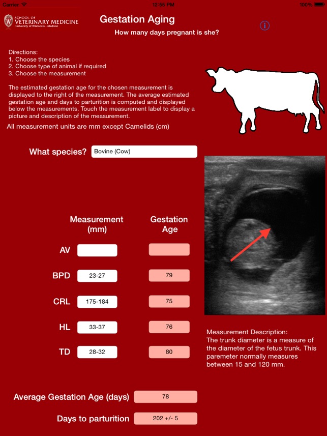 Gestation Aging(圖2)-速報App