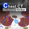 Chest CT Sectional Walker - Ryo Matsuda