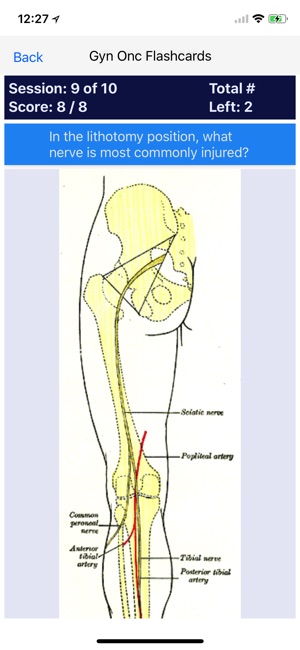 GYN ONC Board Review