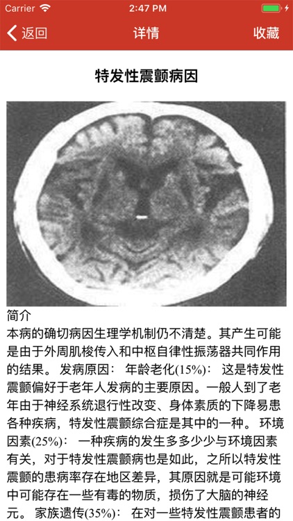 医来伸手震颤