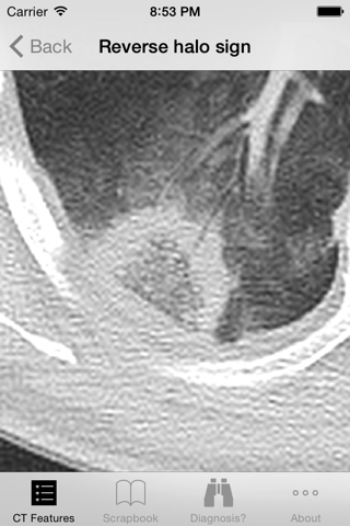 Lung CT Field Guide - náhled