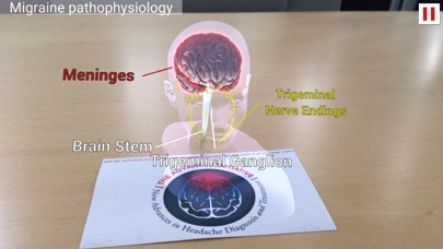 How to cancel & delete ADVANCES Migraine AR from iphone & ipad 3