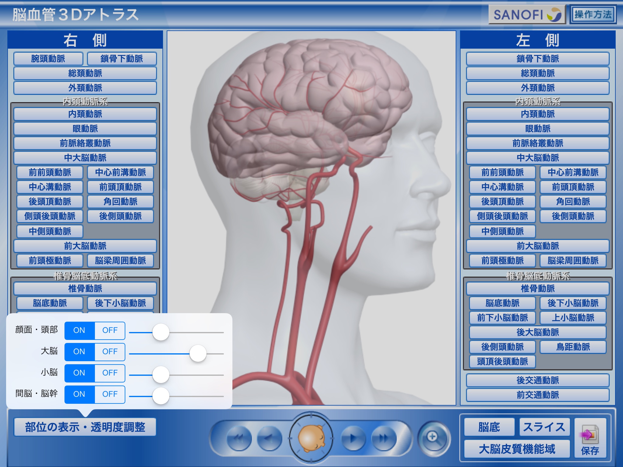 脳血管3Dアトラス　 screenshot 2