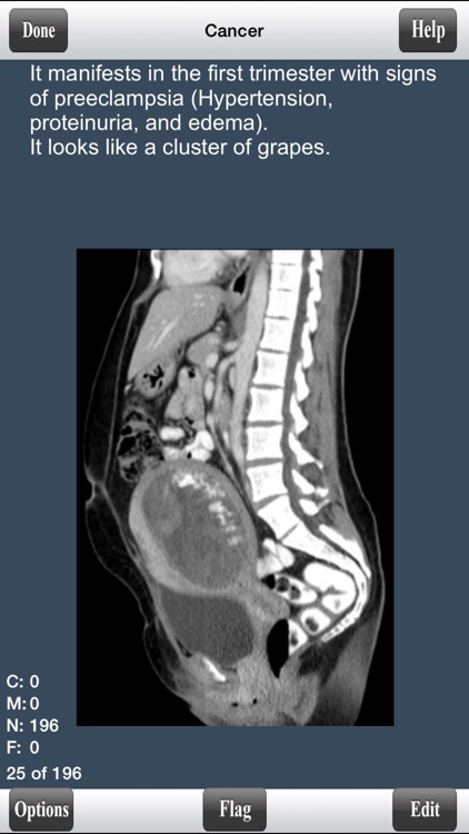 USMLE Step 1 Pathology Flashcards