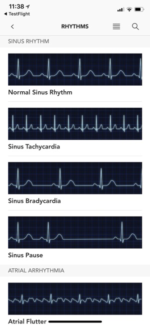 Instant ECG - Mastery of EKG