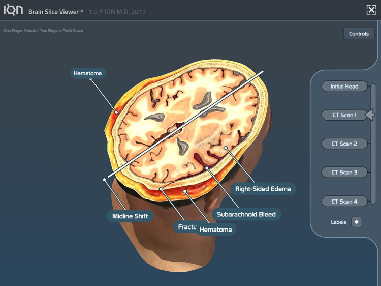 ION Brain Slice Viewer