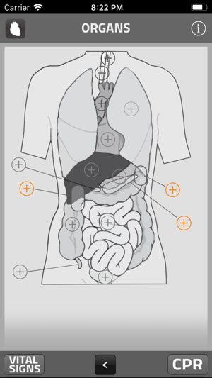 PARAMEDIC: SIGNS AND SYMPTOMS(圖4)-速報App