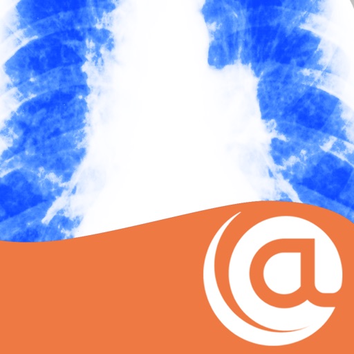 Cystic Fibrosis @Point of Care iOS App