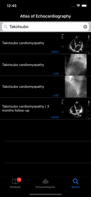 CARDIO3®Echocardiography(圖5)-速報App