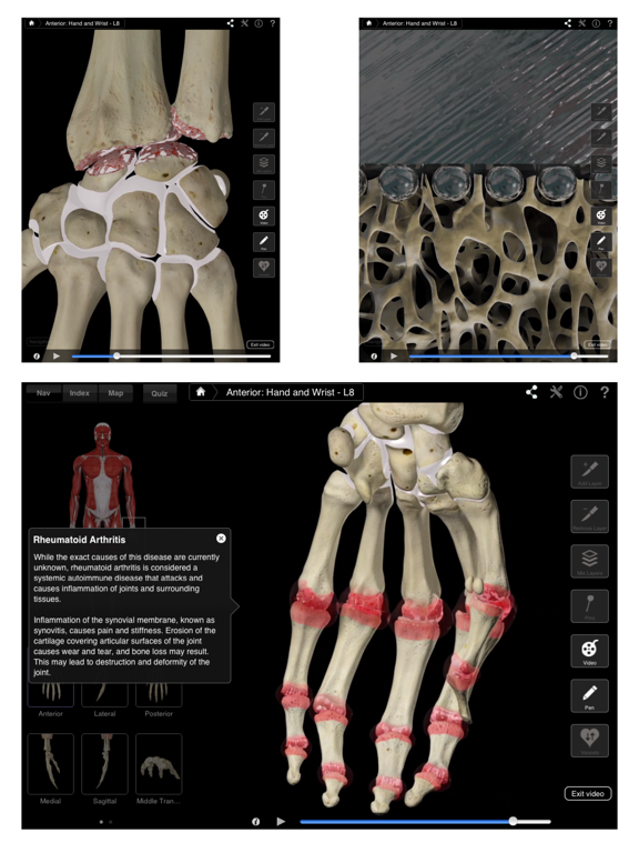 Hand & Wrist Pro III for iPadのおすすめ画像3