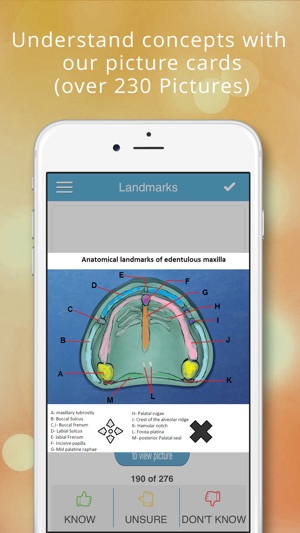 NBDE Dental Boards - Prostho(圖2)-速報App