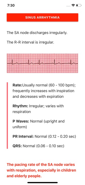 ECG FlashCards Pro