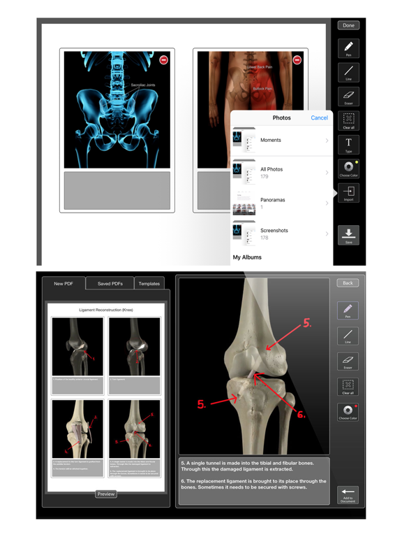 Orthopedic Patient Educationのおすすめ画像3