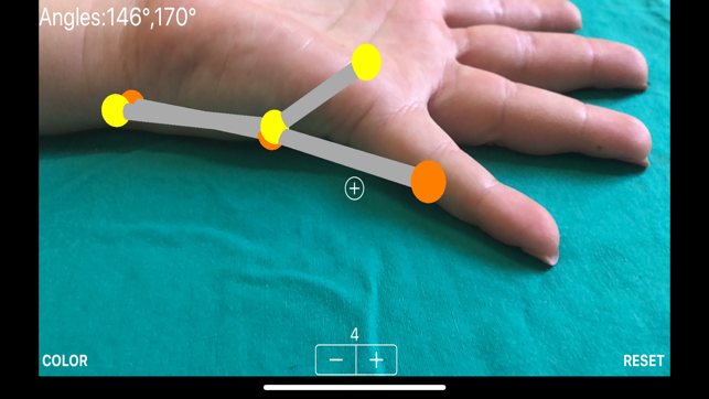 ARorthopaedicGoniometer(圖1)-速報App