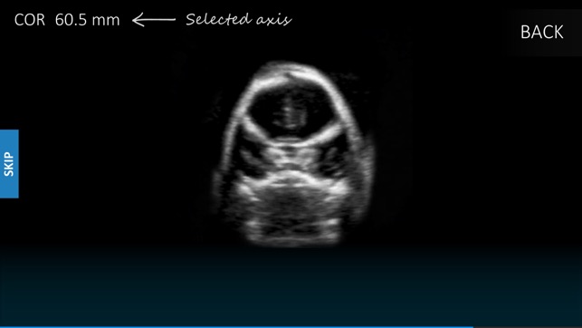 Fetal Brain Tutor 4us(圖3)-速報App