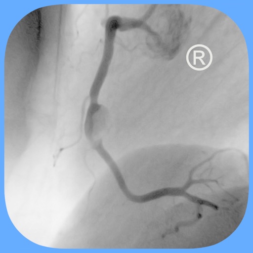 CARDIO3® Interventional Atlas