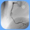 CARDIO3® Atlas of Interventional Cardiology is a CARDIO3®INVASIVE project – reference/learning tool for cardiologists, cardiac surgeons, internists, other physicians evaluating interventional images in cardiology