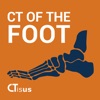 CTisus: CT of the Foot