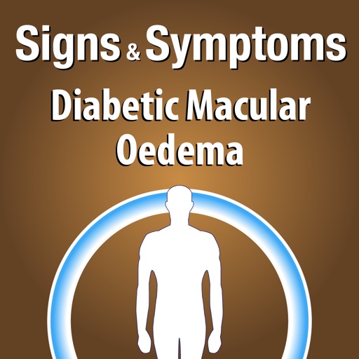 Signs & Symptoms Diabetic Malucar Oedema