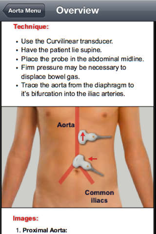 Emergency Medicine Ultrasound screenshot 2