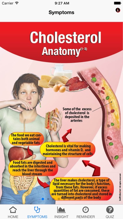 Signs & Symptoms Cholesterol