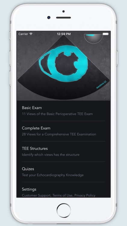 ECHO Views - Transesophageal Echocardiography