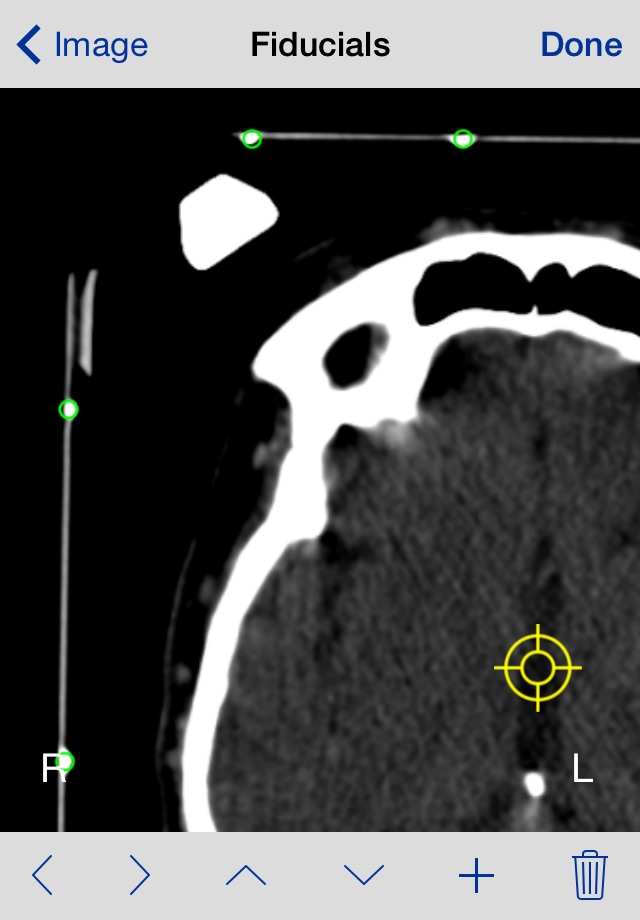 StereoCheck screenshot 2