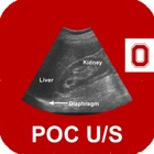 POC Ultrasound Guide