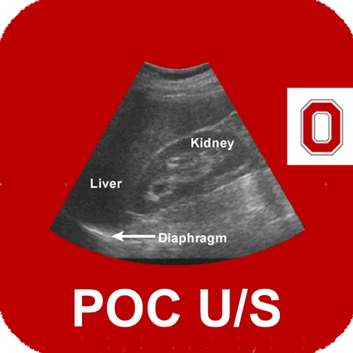 POC Ultrasound Guide Icon