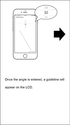 Smart Puncture Basic