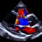 Unique to EchoLab among echocardiography applications is the powerful Analytic Engine, which synthesizes results from multiple calculations into a cohesive overview with a comprehensive summary, with integration of 2015 ASE/EACVI cardiac chamber quantification guidelines and 2014 ACC/AHA guidelines for valvular heart disease