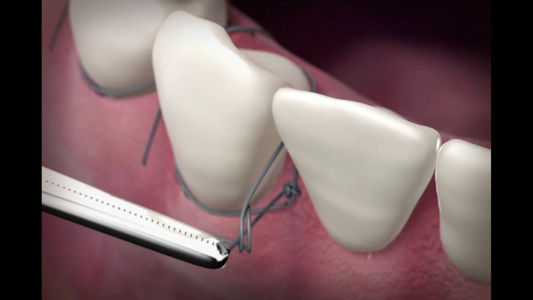 The Oral Surgery Suture Trainer