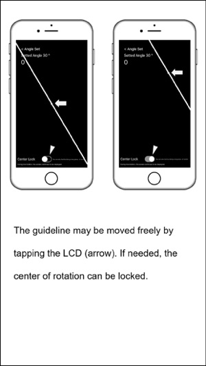 Smart Puncture Basic(圖3)-速報App