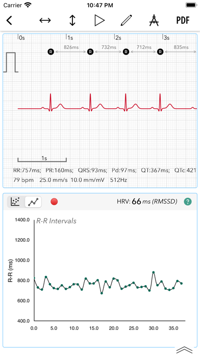 ECG Analyzer for HRV