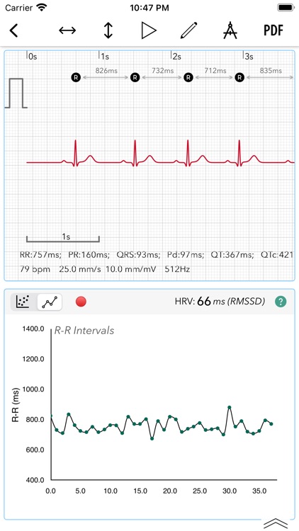 ECG Analyzer for HRV screenshot-2