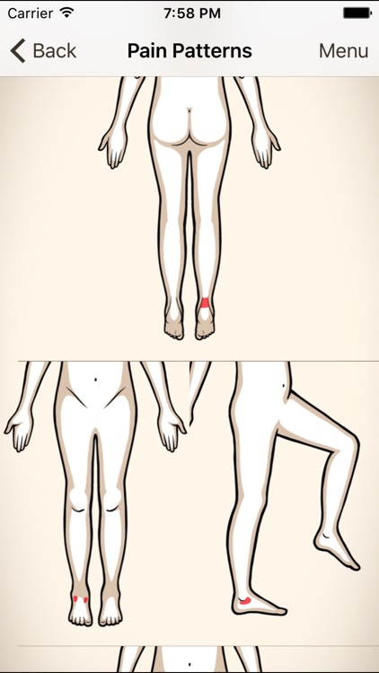 Clinical Pattern Recognition: Ankle and Foot Pain