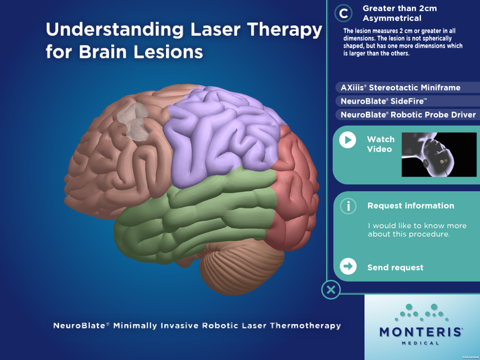 Laser Therapy for Brain Lesions - iPad Version screenshot 3